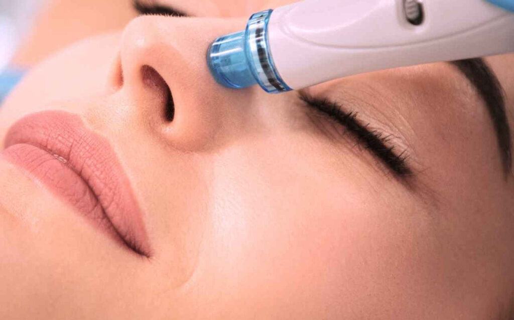 Microneedling (Ameson Mesotherapy) at The Beauty Quarters Salon Oranmore, Galway. Laser hair removal, treatments, makeup
